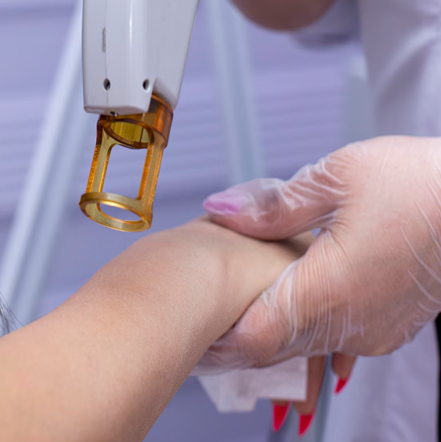 Summus Class IV LASER