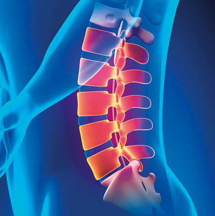Spinal Decompression Therapy